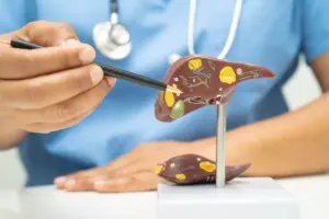 Liver Tumors: Vital Guide To Internal Health