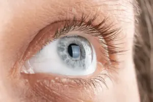 How to Recognize Cornea Scratch Symptoms