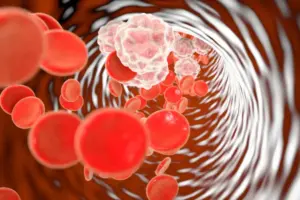 7 Best All in One Anti Inflammatory Supplements for Relief