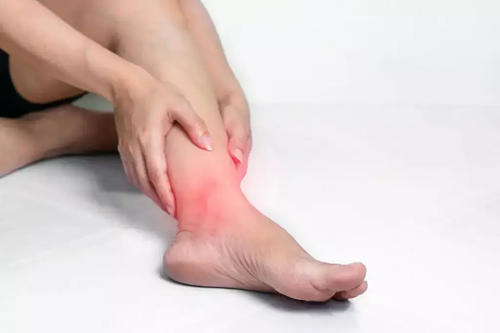 4 Stages of Gout: Symptoms, Duration & Early Warning Signs 2 image 3395 LIV Hospital