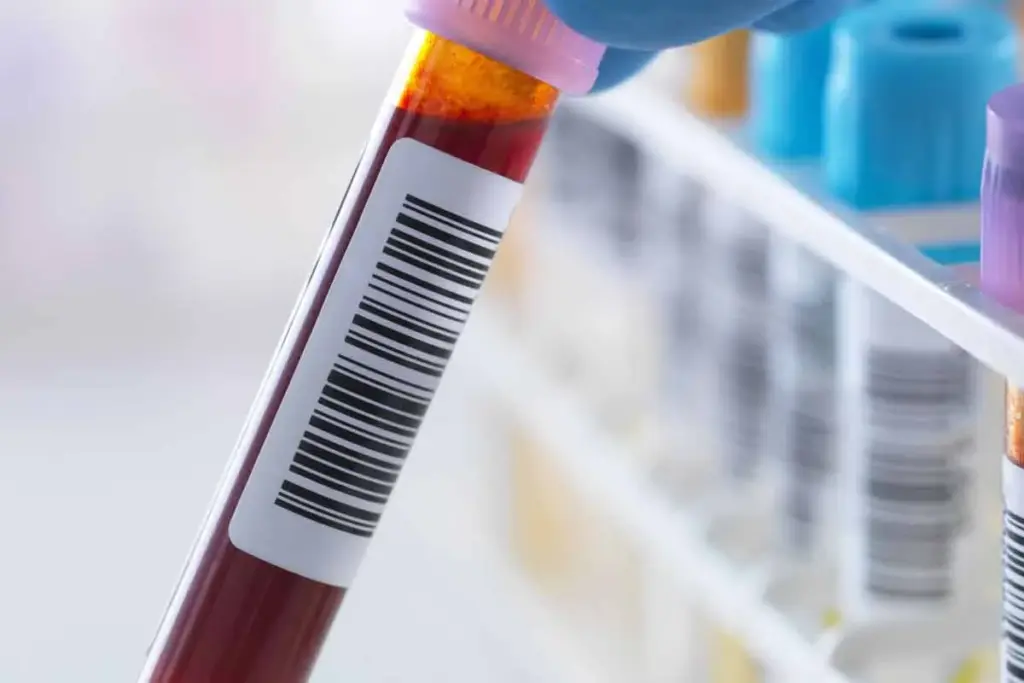 How to Get Diagnosed With Rheumatoid Arthritis: Tests & Labs