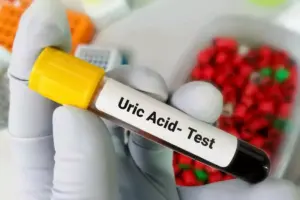 What Labs and Tests Can Detect Gout?