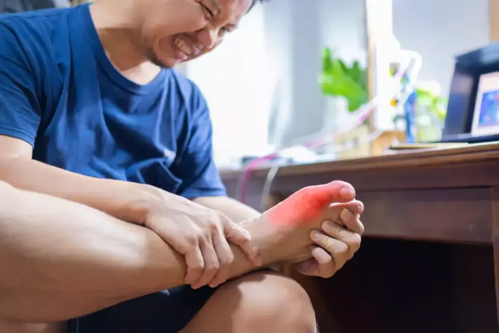 Gout on Outside of Foot: Why It Happens