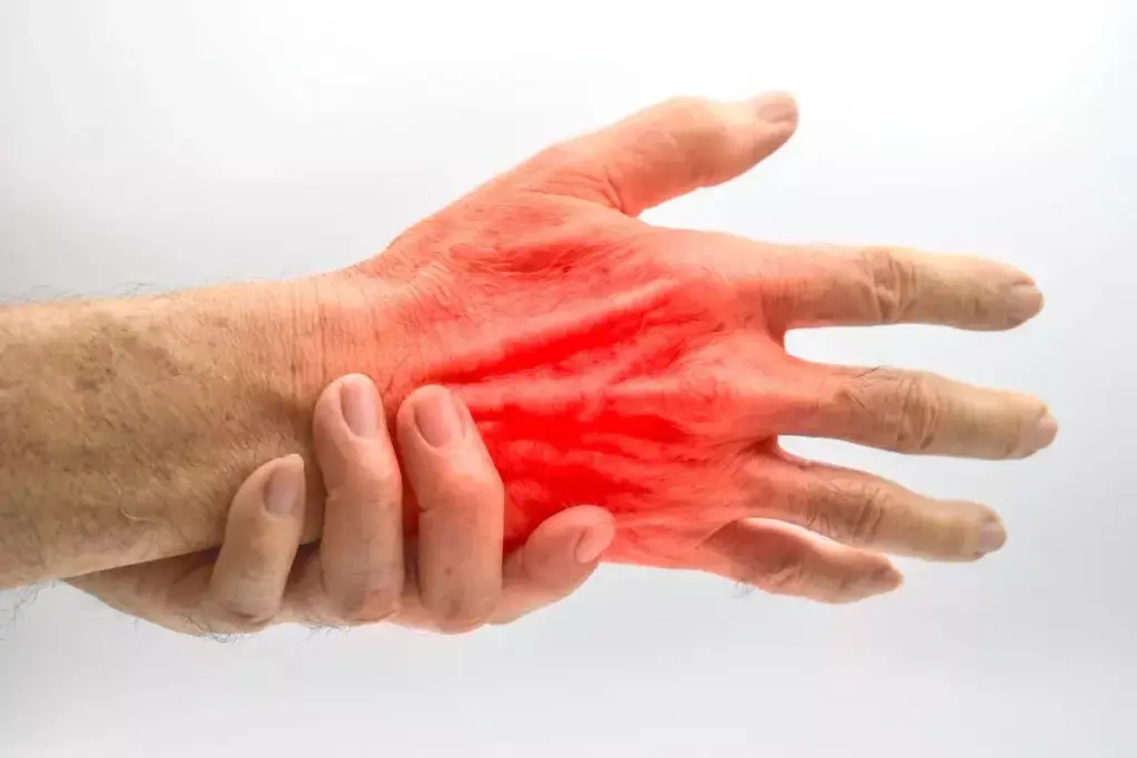 Common Causes of Palm and Thumb Pain