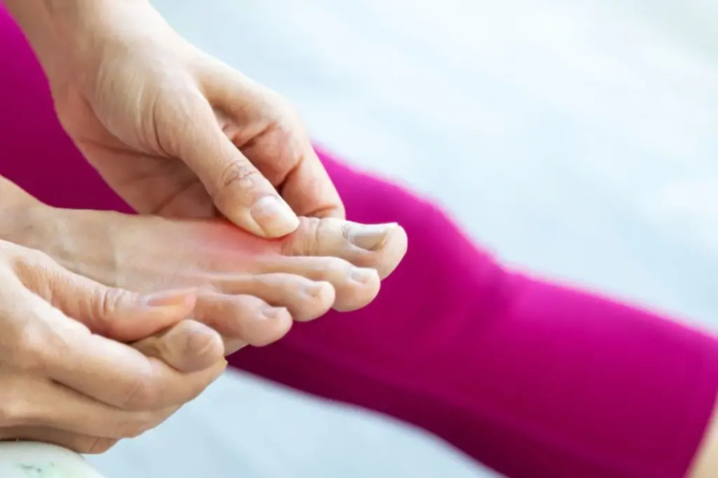 What is Gouty Arthropathy and How Does it Differ from Gout?
