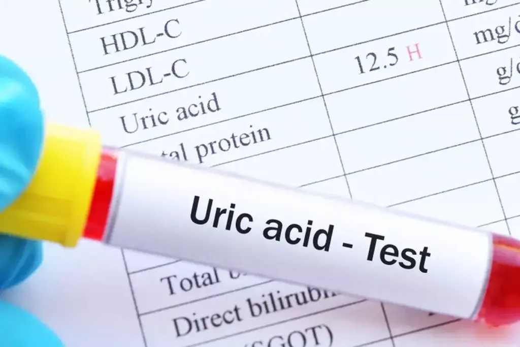 Understanding Uric Acid in the Body