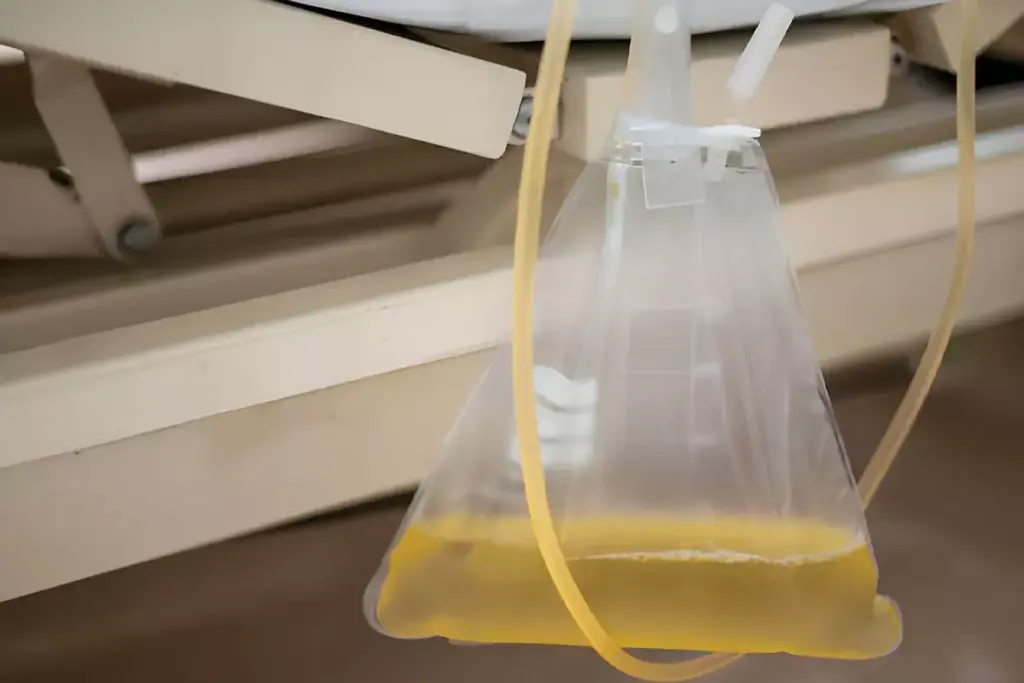 Understanding Urine Color and Hydration