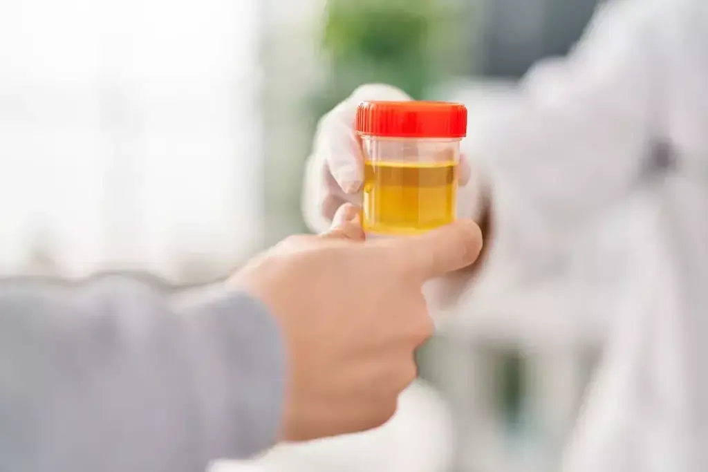 Understanding High RBC Levels in Urine (Hematuria)