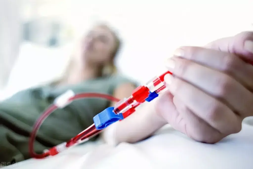 Understanding Dialysis and Life Expectancy