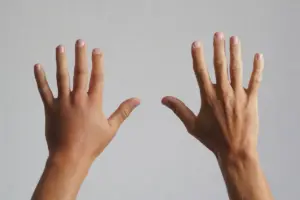 Why Do My Hands Swell When I Wake Up?
