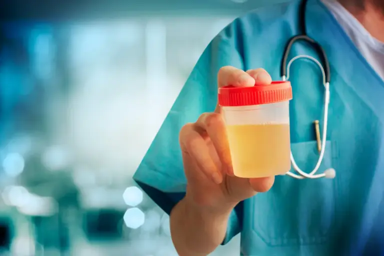 How to Treat Milky White Urine: Causes and Solutions