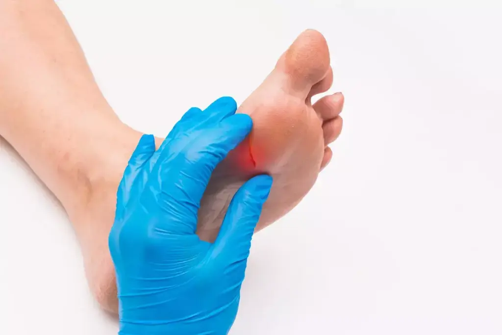 Essential Steps to Prepare for Your Diabetic Foot Exam