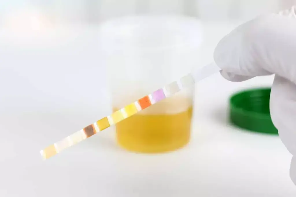 Understanding Glucose in Urine: What's Normal and What's Not