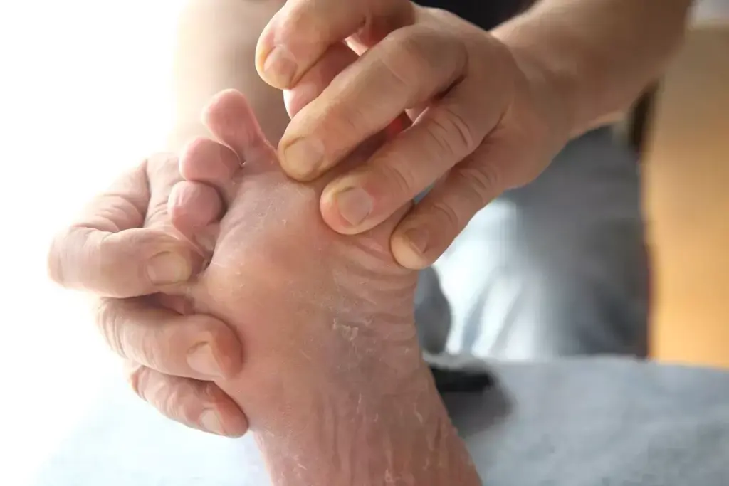 How Diabetes Affects Your Feet