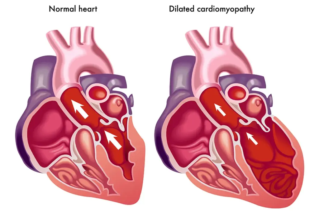 The TAVR Incision Size: What Patients Can Expect