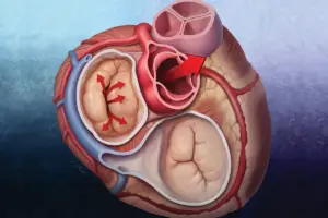 TAVR: Small Incisions For A Great Recovery