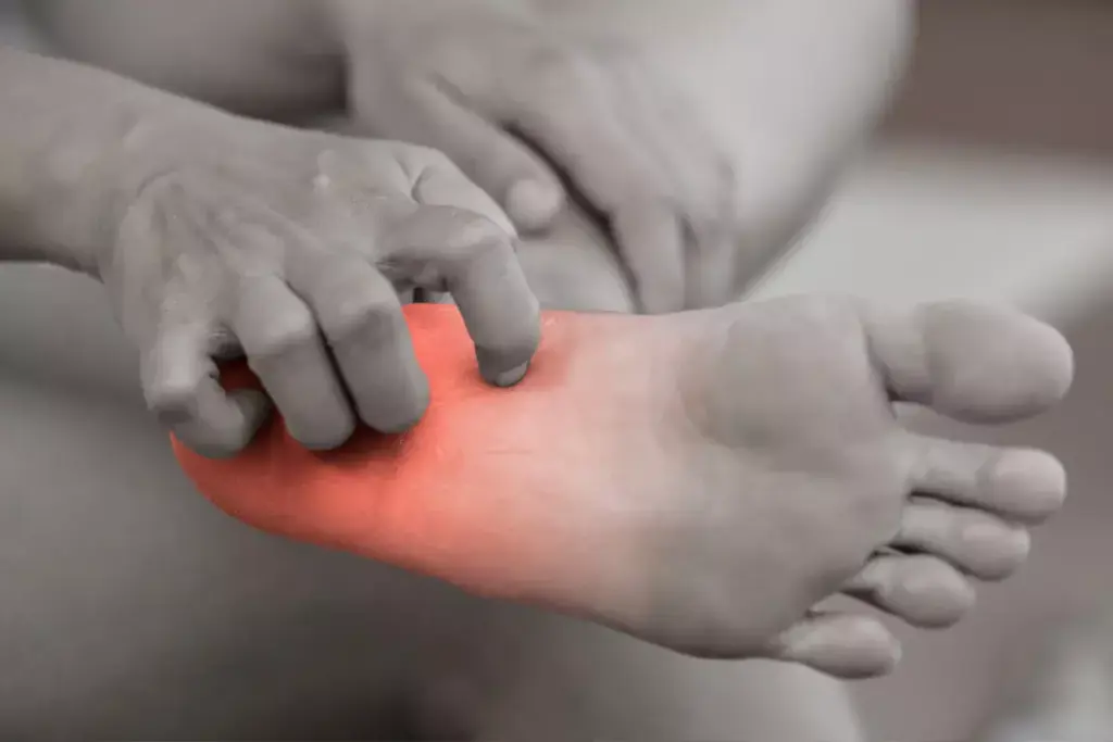 Understanding Diabetic Skin Complications and Their Prevalence