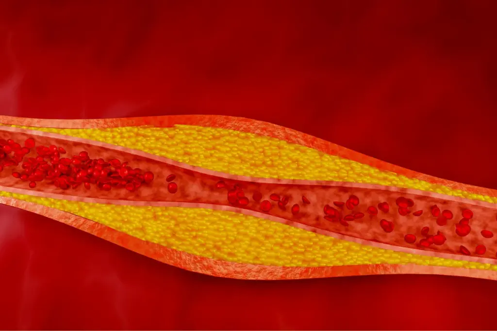 SEP 10077 image 3 LIV Hospital