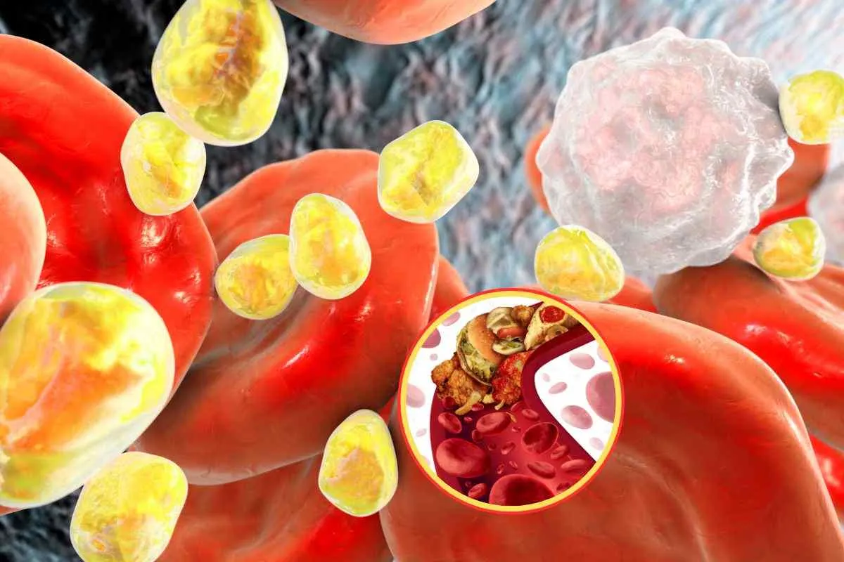 Hyperlipidemia: Hidden Signs You Should Not Ignore