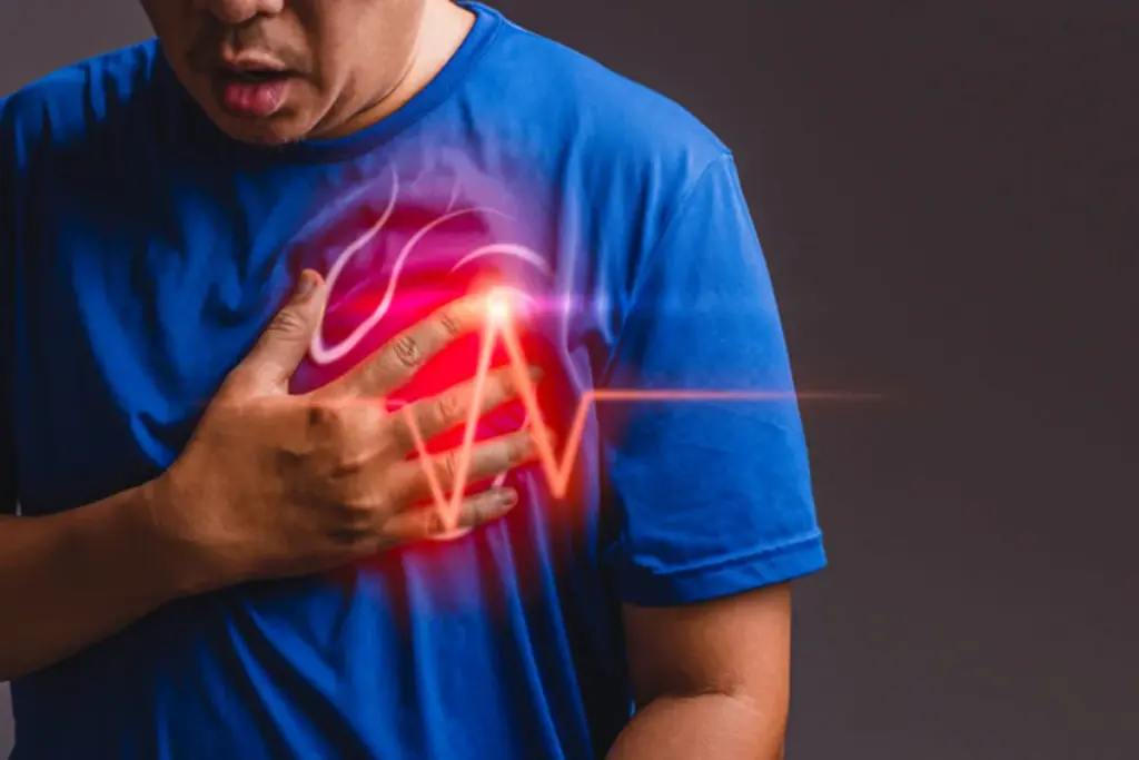 Understanding Afib: The Most Common Serious ArrhythmiaVV