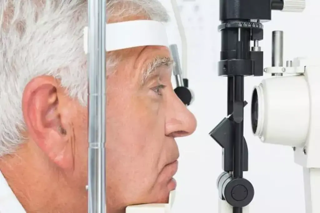 Five Critical Clinical Signs of Glaucomatous Optic Nerve Damage