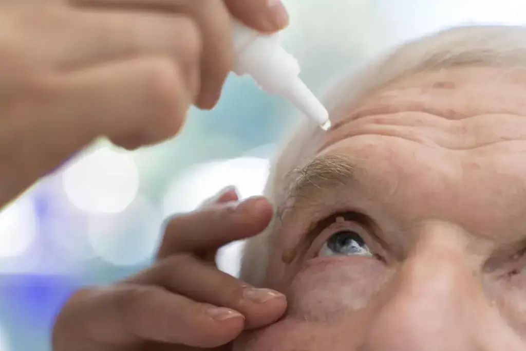 Step 2: Implementing Comprehensive Medical Therapy for Glaucoma