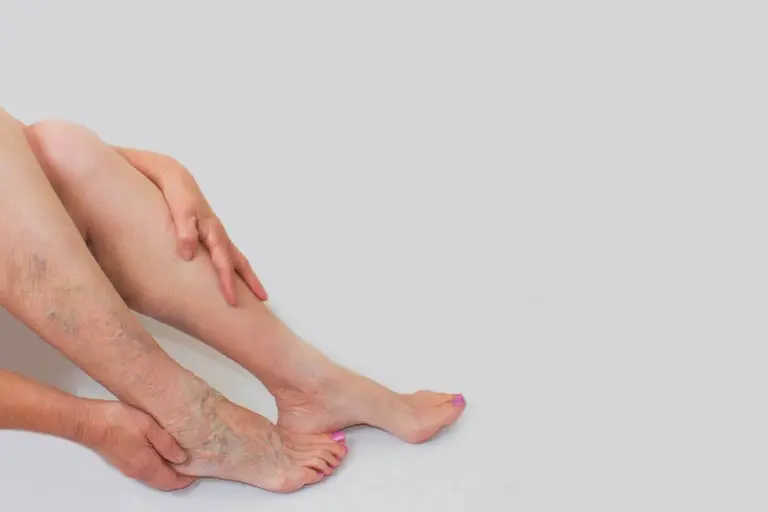 Do Blood Clots Go Away? Miraculous Healing Facts