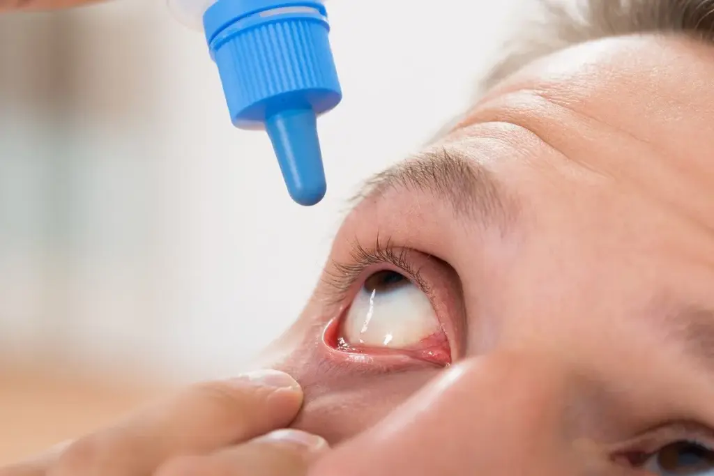 How to Use Anti-Glaucoma Medications Effectively