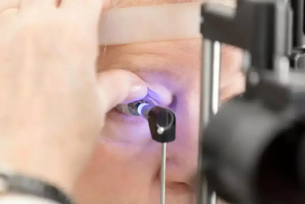 1. What Is a Bilateral Glaucoma Suspect?