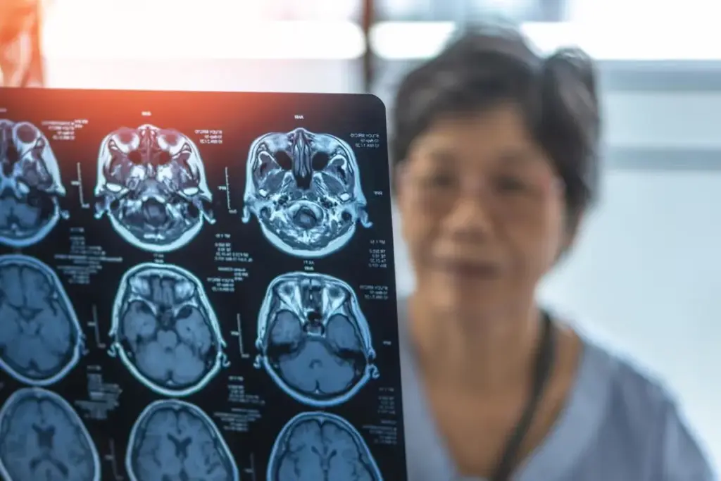 The Reality of Unexpected Brain MRI Findings