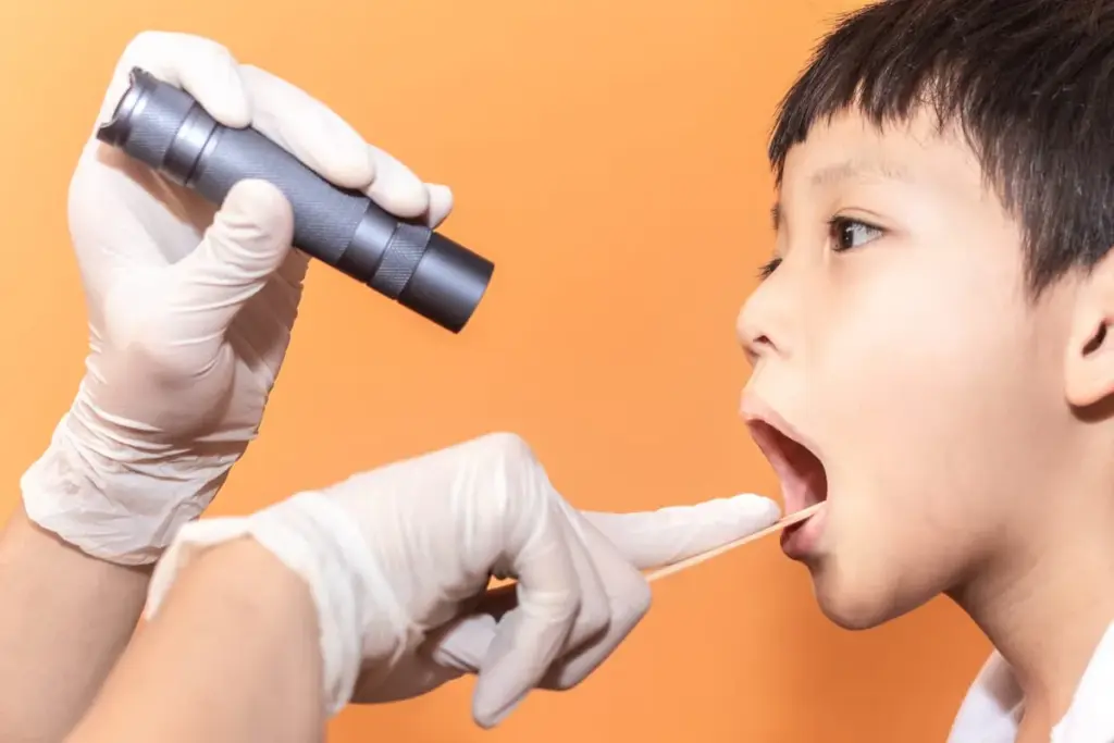 Tonsils Removed? Why Some Doctors May Advise Against