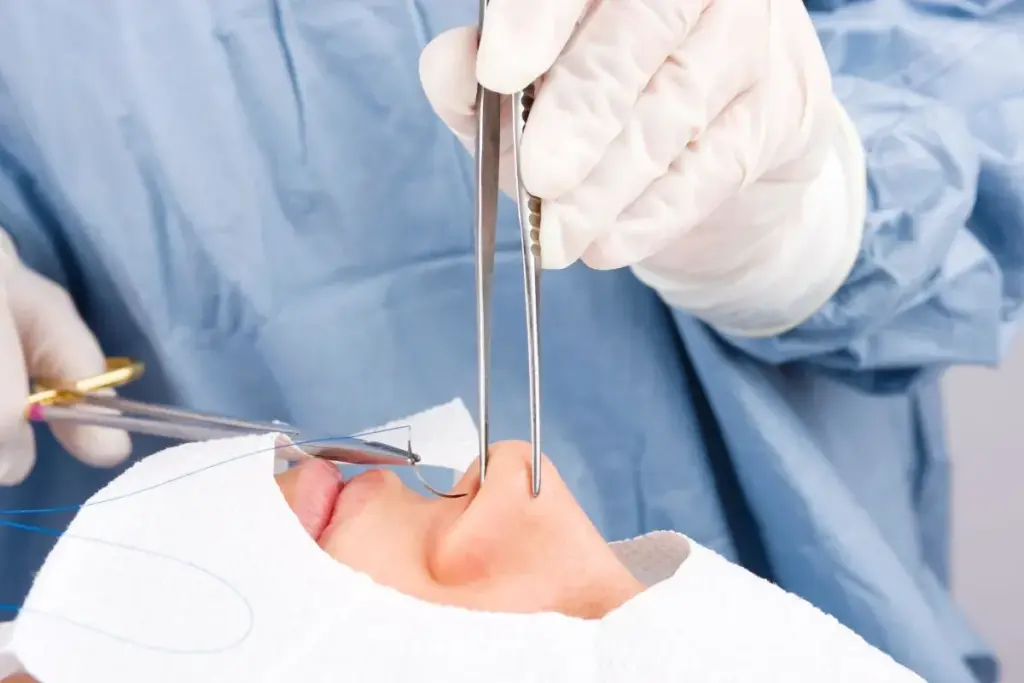 Types of Sinus Surgeries Requiring Nasal Packing