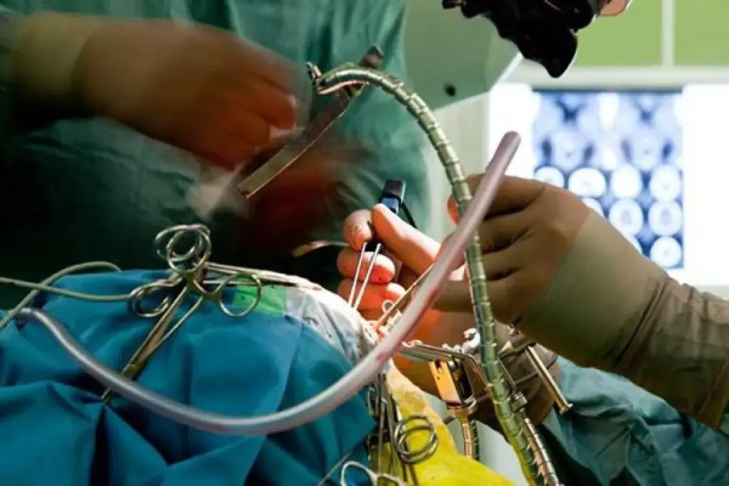 Craniotomy: Inspiring Tips For A Normal Life 3 What is a Craniotomy? Procedure Overview