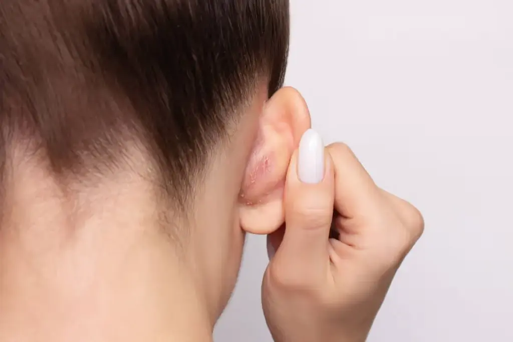 Myringotomy Ease: A Quick And Simple Process 1 Myringotomy Ease: A Quick And Simple Process