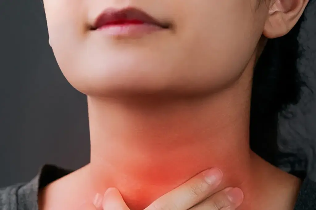 Understanding Vocal Cord Dysfunction