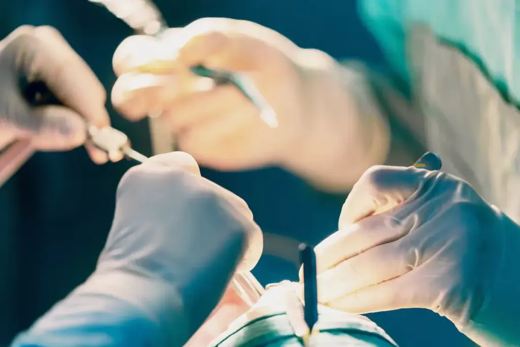 Understanding Deviated Septum and Its Breathing Impact