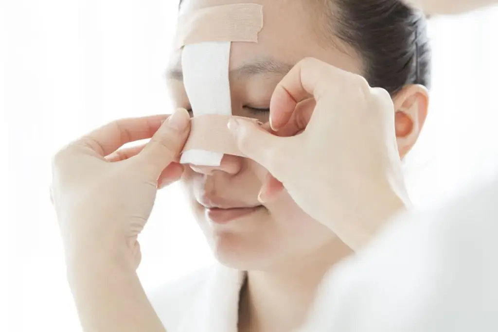 The Basics of Septoplasty Surgery