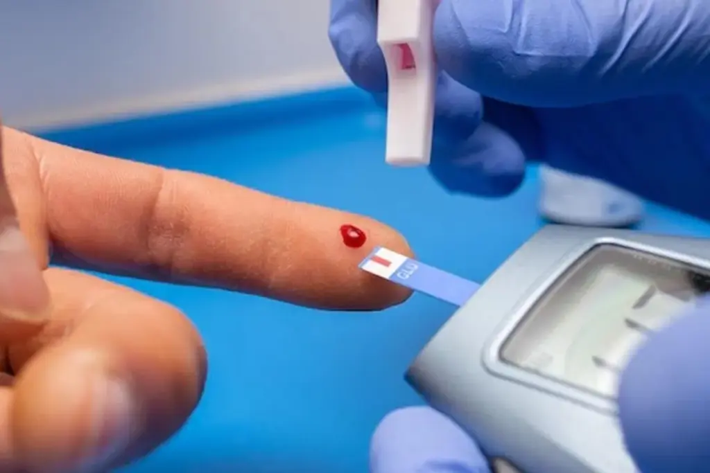 Can Diabetes Be Detected in a Urine Test?
