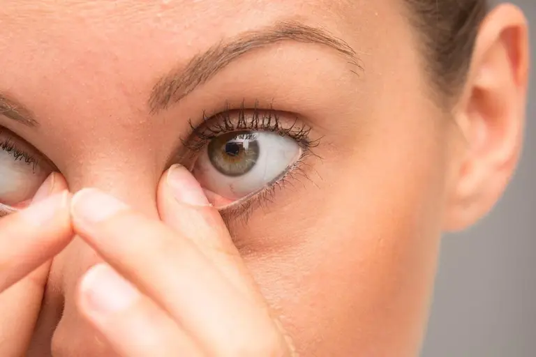 5 Narrow Angles in Eyes Symptoms: What You Need to Know