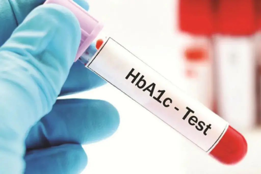 How to Calculate A1C From Blood Glucose at Home