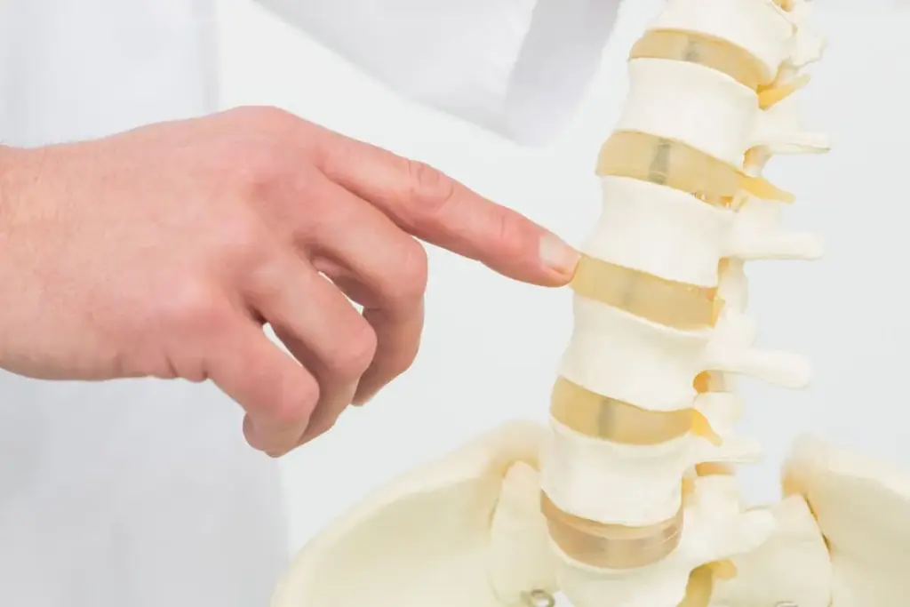 How Serious Is Osteoarthritis of the Spine? 1 How Serious Is Osteoarthritis of the Spine?