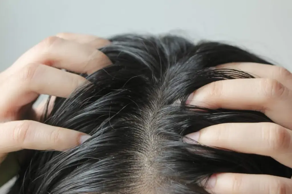 12 Common Scalp Conditions: Types, Symptoms & Treatments