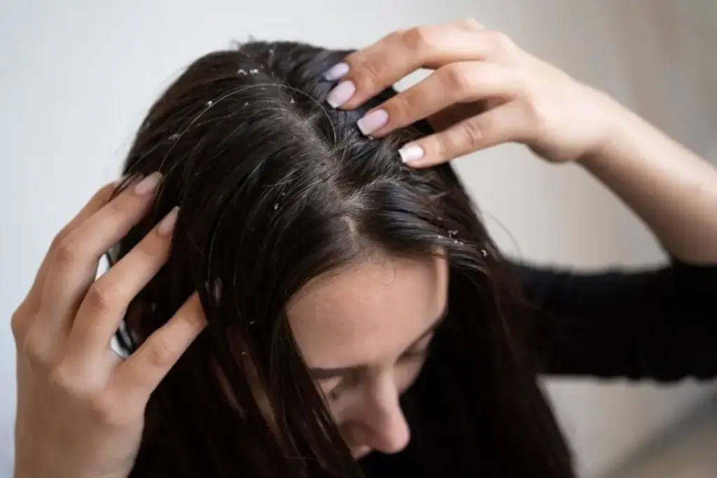 12 Common Scalp Conditions: Types, Symptoms & Treatments