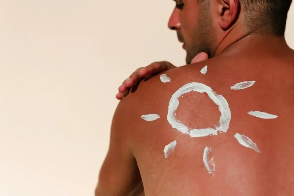 Can Black Skin Get Sunburn? Healing Tips