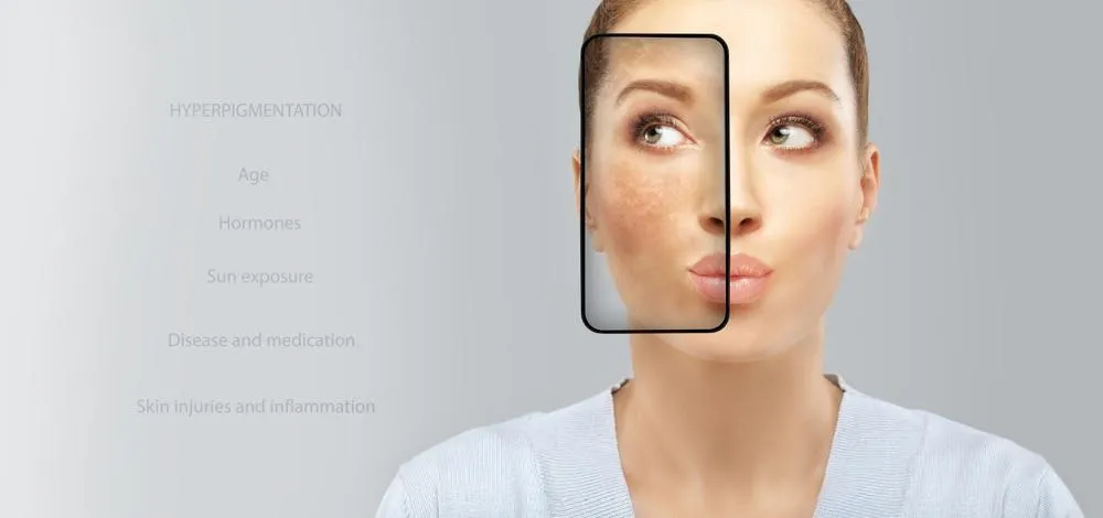 SEP 13428 image 6 LIV Hospital