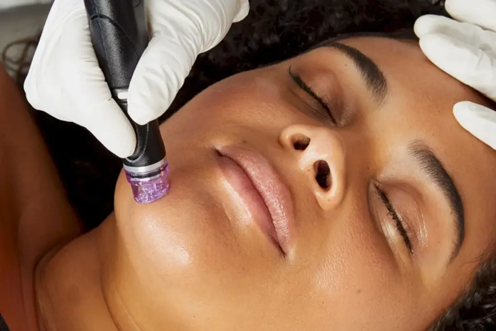 Hydrafacial Benefits: Why It Is Worth It 1 Hydrafacial Benefits: Why It Is Worth It