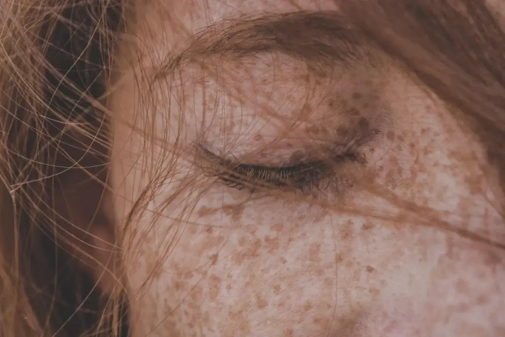 Can Freckles Be Skin Cancer? How to Tell the Difference 3 Can Freckles Turn Into Skin Cancer?