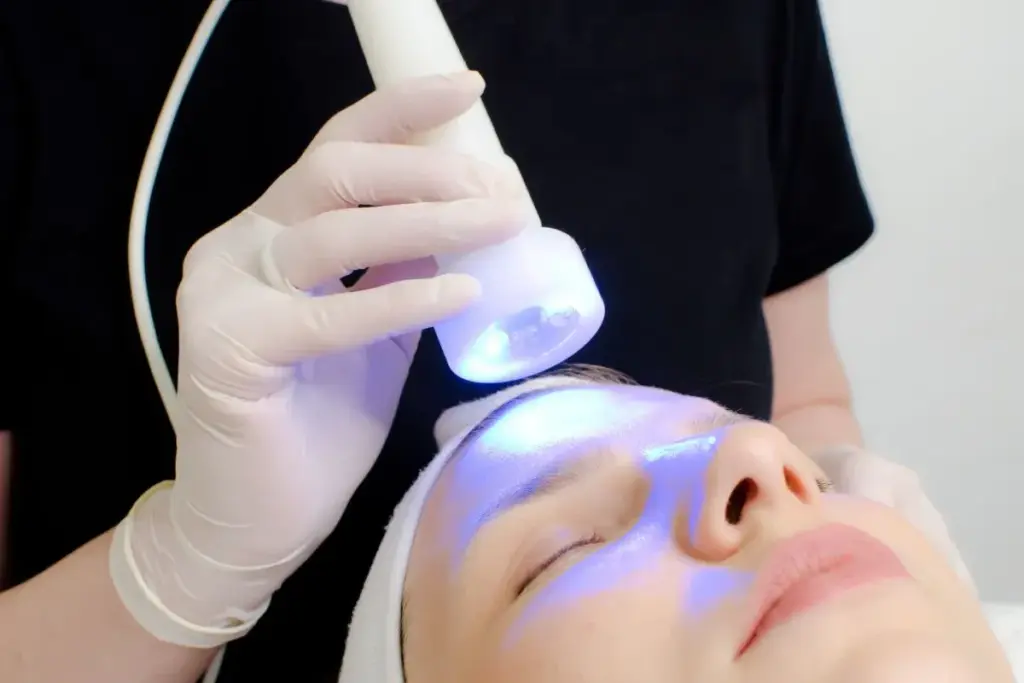 Does Blue Light Therapy Actually Work for Mild Acne? 2 Understanding Blue Light Therapy and Its Mechanism for Acne Treatment