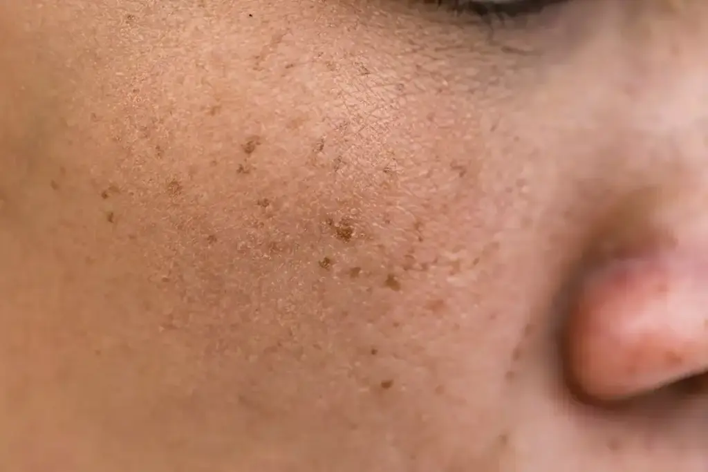 How Deep Are Sunspots Under the Skin and Are They Permanent?