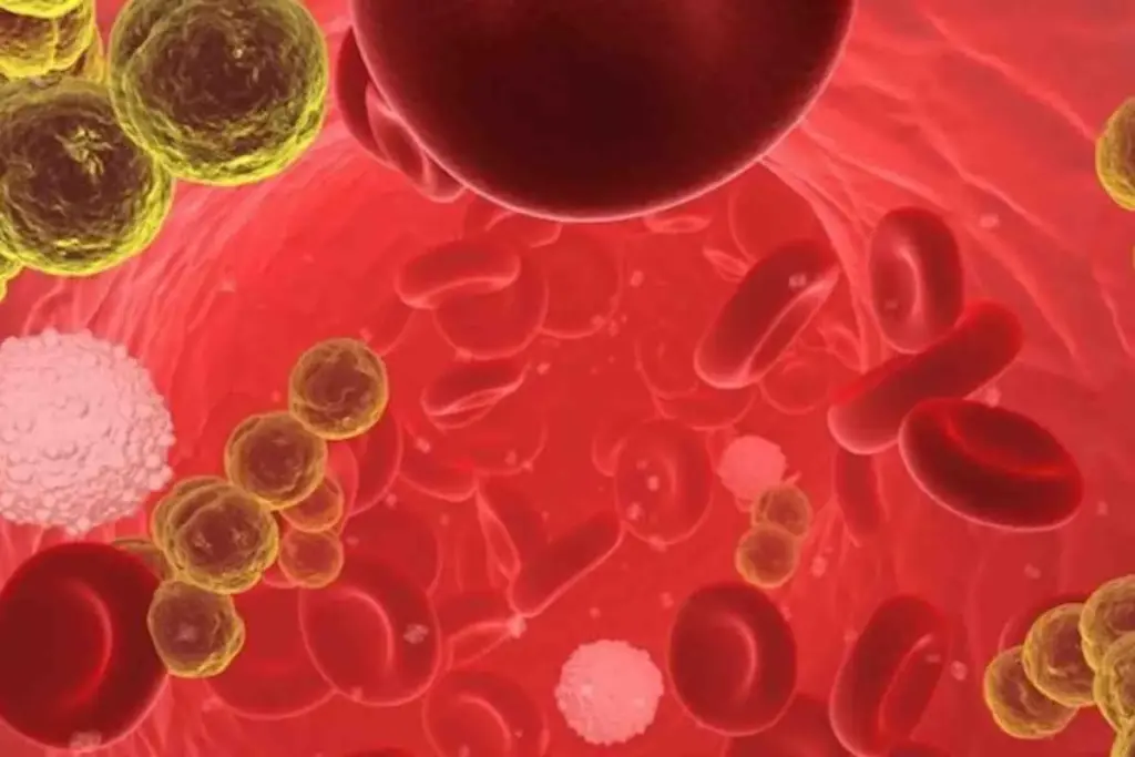 SEP 13597 image 2 LIV Hospital